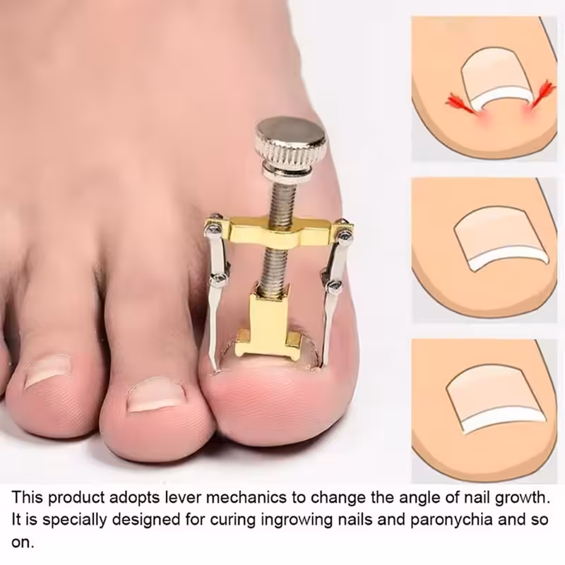 دستگاه اصلاح فرم و ارتودنسی ناخن مدل Nails