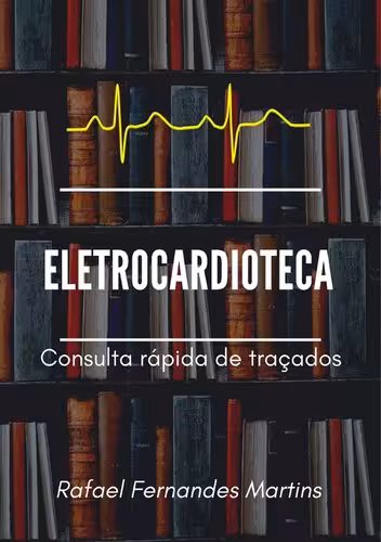 خرید و دانلود نسخه کامل کتاب Eletrocardioteca: consulta rápida de traçados