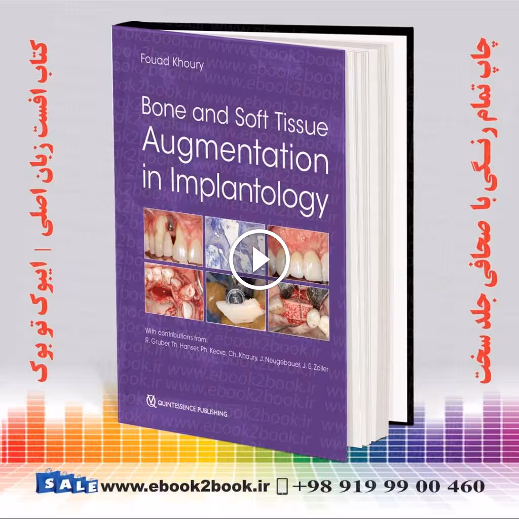 Bone and Soft Tissue Augmentation in Implantology