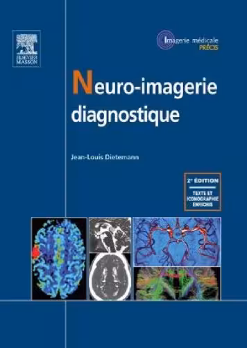 خرید و دانلود نسخه کامل کتاب Neuro-imagerie diagnostique