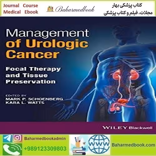 Management of Urologic Cancer Focal Therapy and Tissue