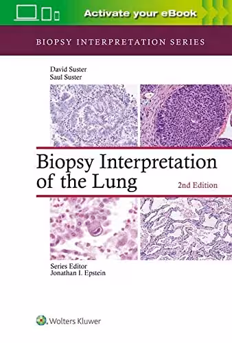 خرید و دانلود نسخه کامل کتاب Biopsy Interpretation of the Lung