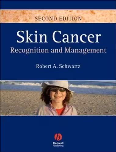 خرید و دانلود نسخه کامل کتاب Skin Cancer: Recognition and Management 2nd Edition