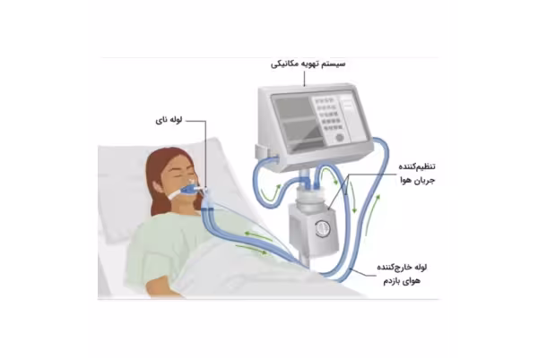 جزوه کامل و خلاصه انواع ونتیلاتور - کتابخانه مجازی واتیکان