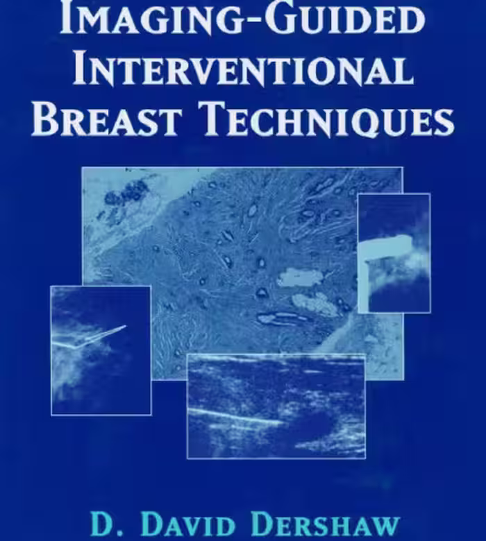 خرید و دانلود نسخه کامل کتاب Imaging-Guided Interventional Breast Techniques