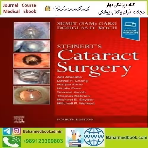 Steinert's Cataract Surgery Video 2023 TRUE PDF price 5€ - کتاب پزشکی بهار