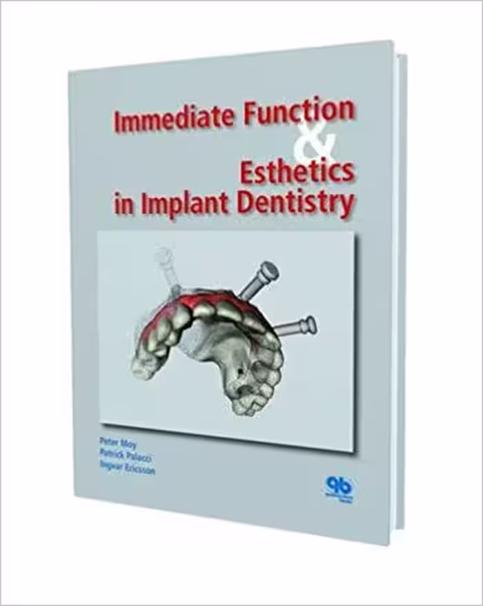 خرید و دانلود نسخه کامل کتاب Immediate Function and Esthetics in Implant Dentistry