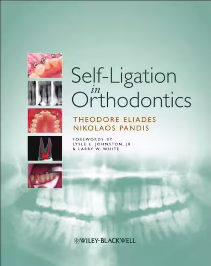 خرید و دانلود نسخه کامل کتاب Self-Ligation in Orthodontics