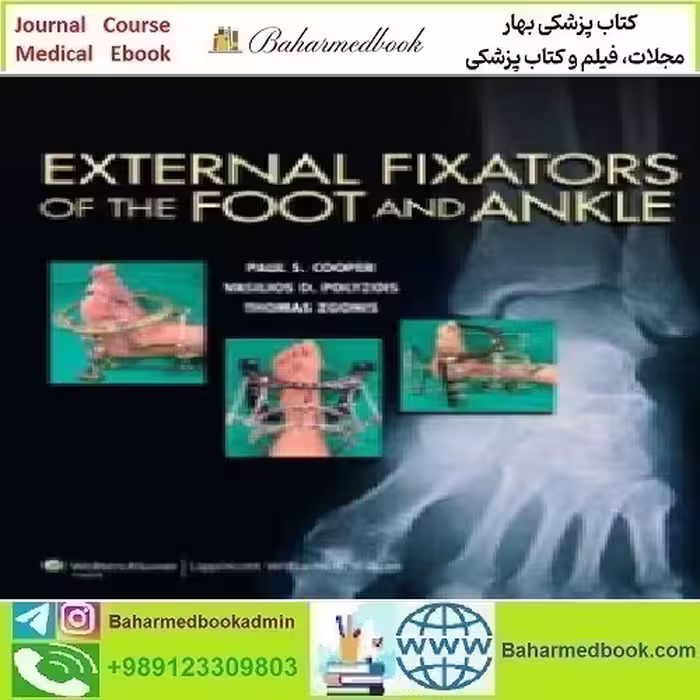 External Fixators of the Foot and Ankle 2013 TRUE PDF price 1€ - کتاب پزشکی بهار