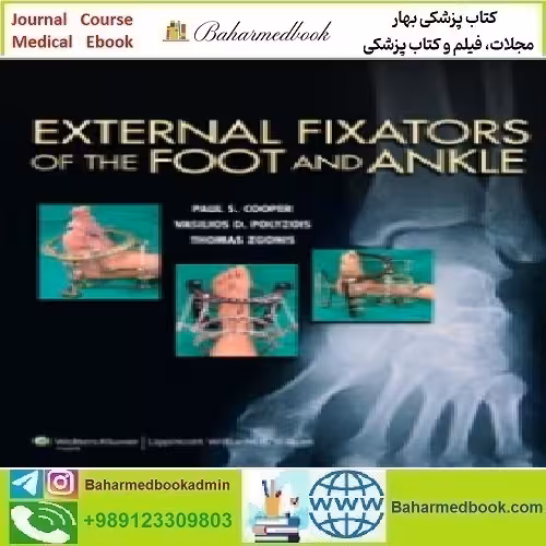 External Fixators of the Foot and Ankle 2013 TRUE PDF price 1€ - کتاب پزشکی بهار
