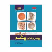 کتاب آسان آموز پزشکی abc medicine درس آزمون بیماری‌های چشم