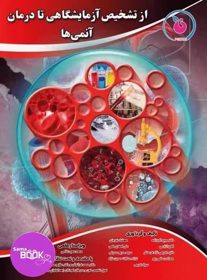 از تشخیص آزمایشگاهی تا درمان آنمی‌ها