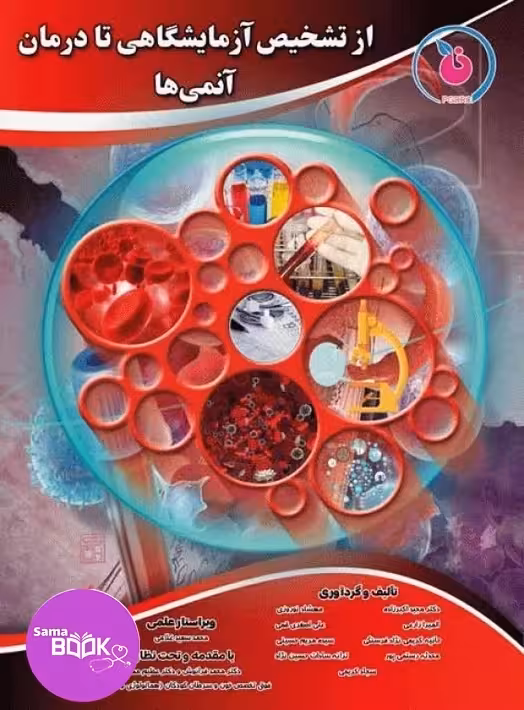 از تشخیص آزمایشگاهی تا درمان آنمی‌ها