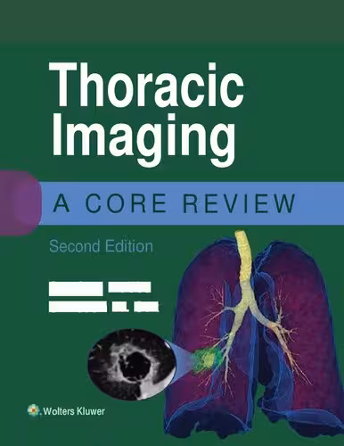 خرید و دانلود نسخه کامل کتاب Thoracic Imaging: A Core Review
