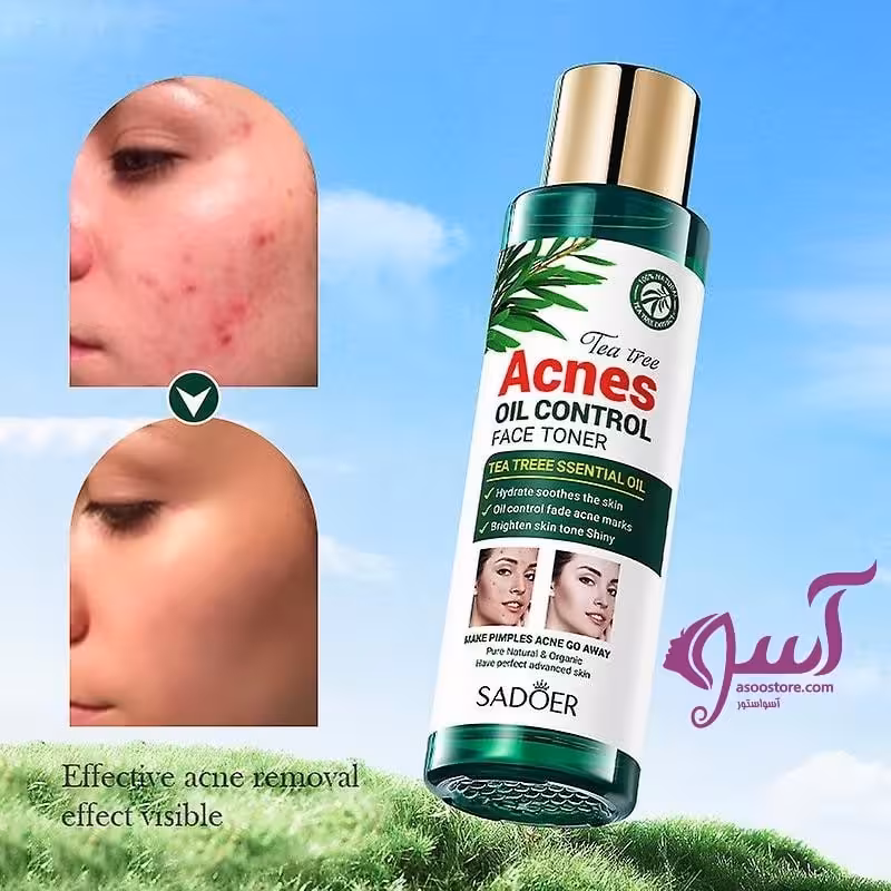 تونر ضد جوش چای سبز اورجینال SD50057