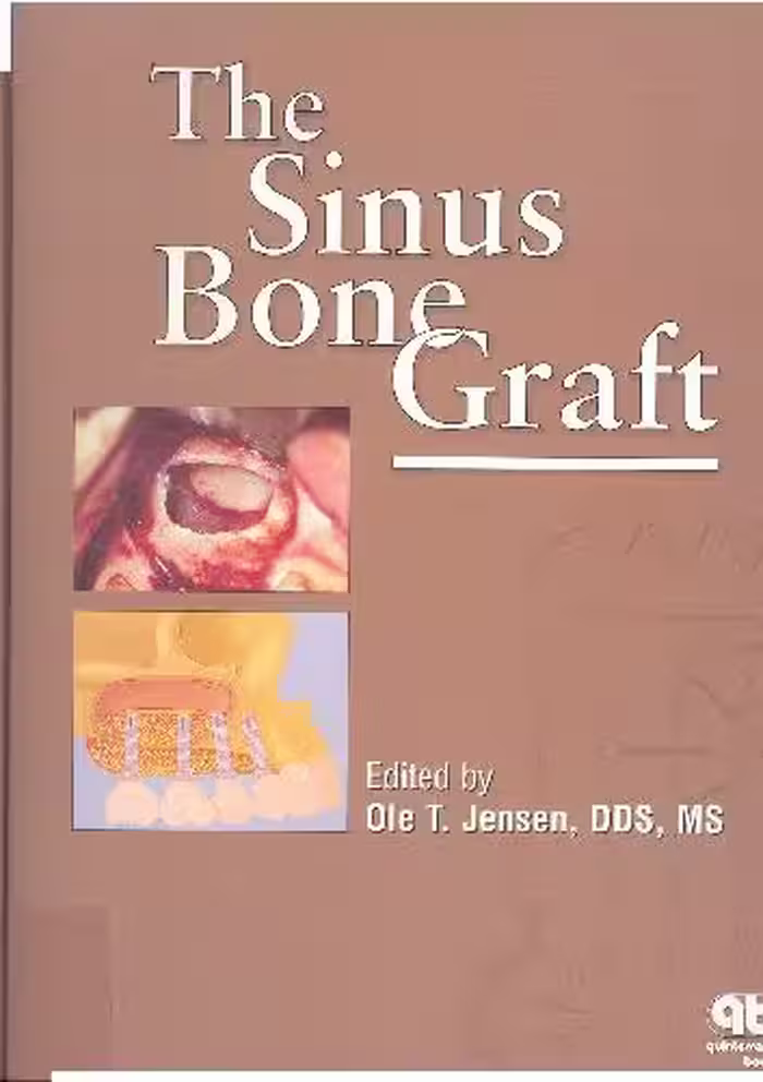 خرید و دانلود نسخه کامل کتاب The Sinus Bone Graft