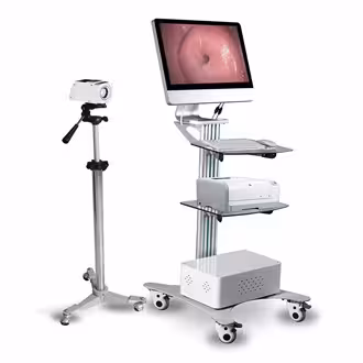 ویدیو کولپوسکوپ دیجیتالی مدل SW-3302