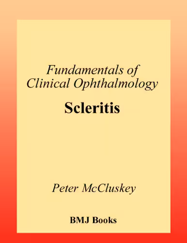 خرید و دانلود نسخه کامل کتاب Scleritis