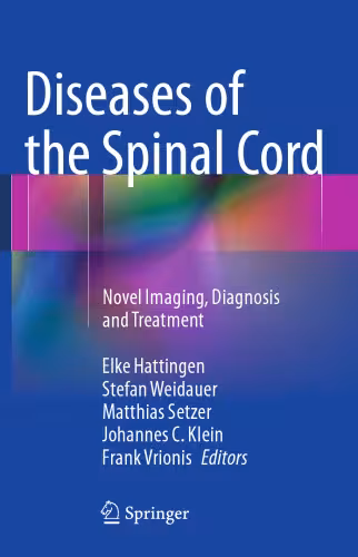 خرید و دانلود نسخه کامل کتاب Diseases of the Spinal Cord: Novel Imaging, Diagnosis and Treatment