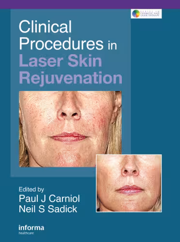 خرید و دانلود نسخه کامل کتاب Clinical Procedures in Laser Skin Rejuvenation (Series in Cosmetic and Laser Therapy)