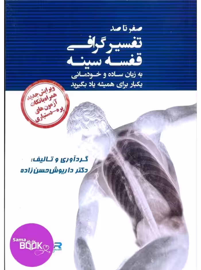 صفر تا صد تفسیر گرافی قفسه سینه