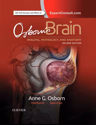 خرید و دانلود نسخه کامل کتاب Osborn’s Brain: imaging, pathology, and anatomy
