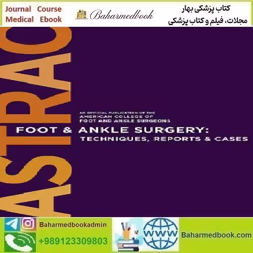 Foot & Ankle Surgery Technique