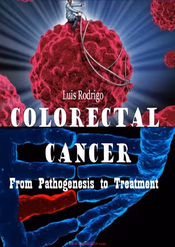 خرید و دانلود نسخه کامل کتاب Colorectal Cancer From Pathogenesis to Treatment