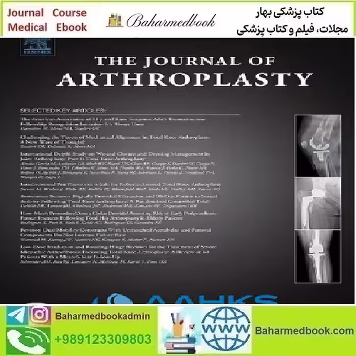 The Journal of Arthroplasty Volume 39 Issue 1 to 4