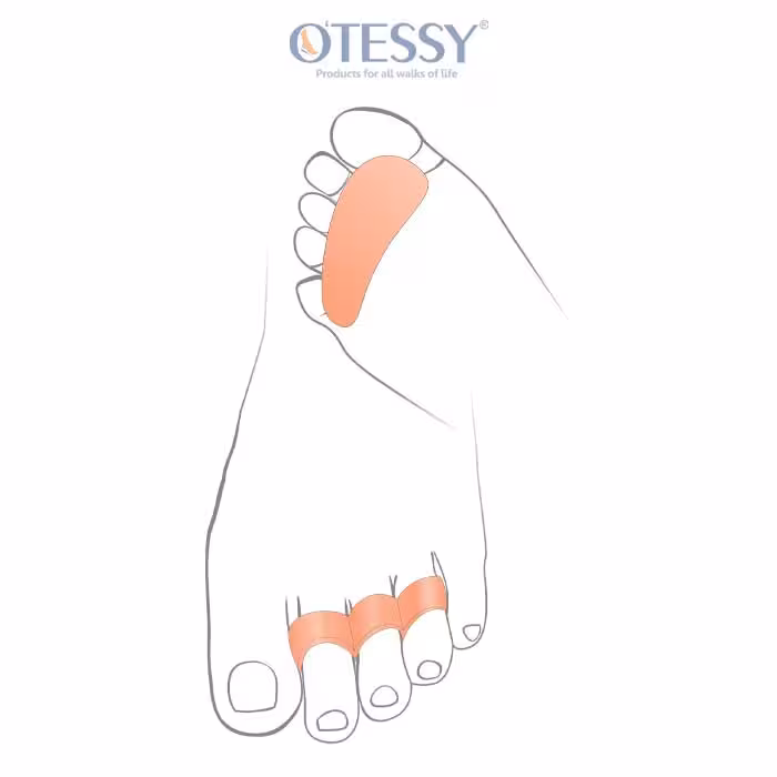 فاصله دهنده سه انگشتی سایز 45-35 OTESSY