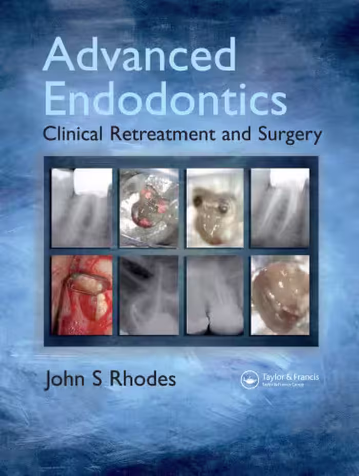 خرید و دانلود نسخه کامل کتاب Advanced Endodontics