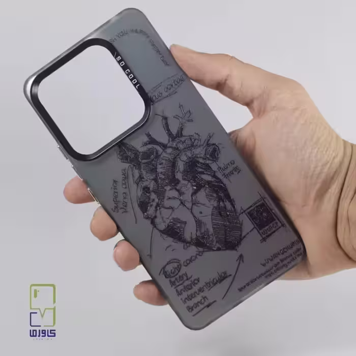 قاب گوشی شیائومی نوت 13 فانتزی | کاور جذاب  Xiaomi Note 13 02