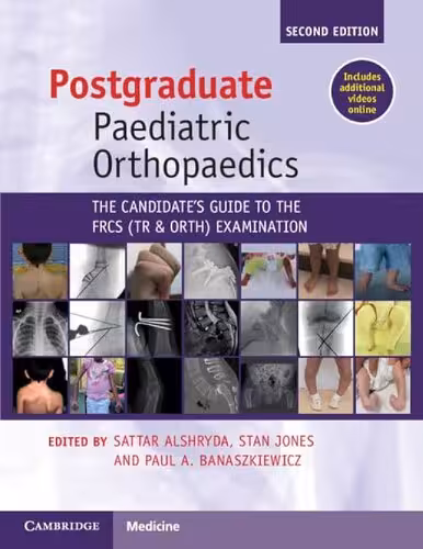 خرید و دانلود نسخه کامل کتاب Postgraduate Paediatric Orthopaedics: The Candidate's Guide to the FRCS (Tr&amp;Orth) Examination