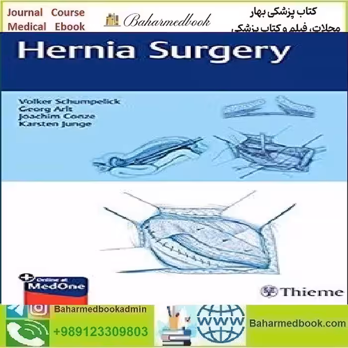 Hernia Surgery TRUE PDF price 1€ - کتاب پزشکی بهار