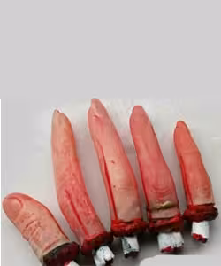 انگشت بریده