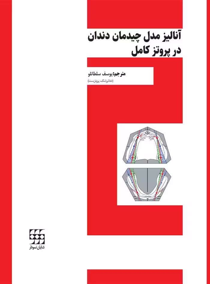 آنالیز مدل چیدمان دندان در پروتز کامل