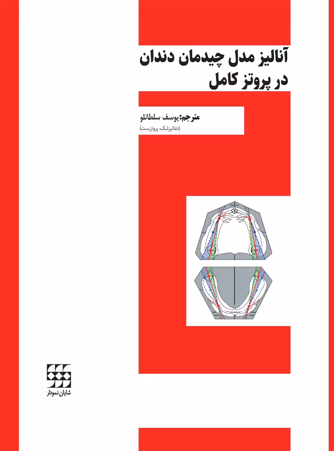 آنالیز مدل چیدمان دندان در پروتز کامل