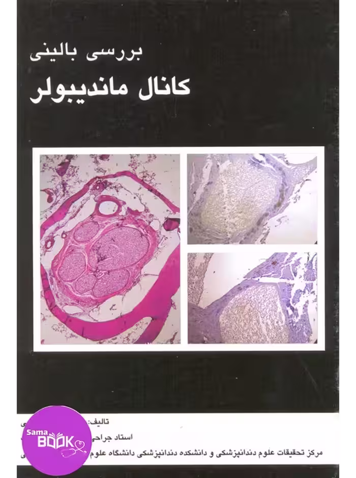 بررسی بالینی کانال مندیبولر