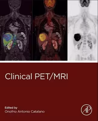 خرید و دانلود نسخه کامل کتاب Clinical PET / MRI - Radiology Molecular Imaging