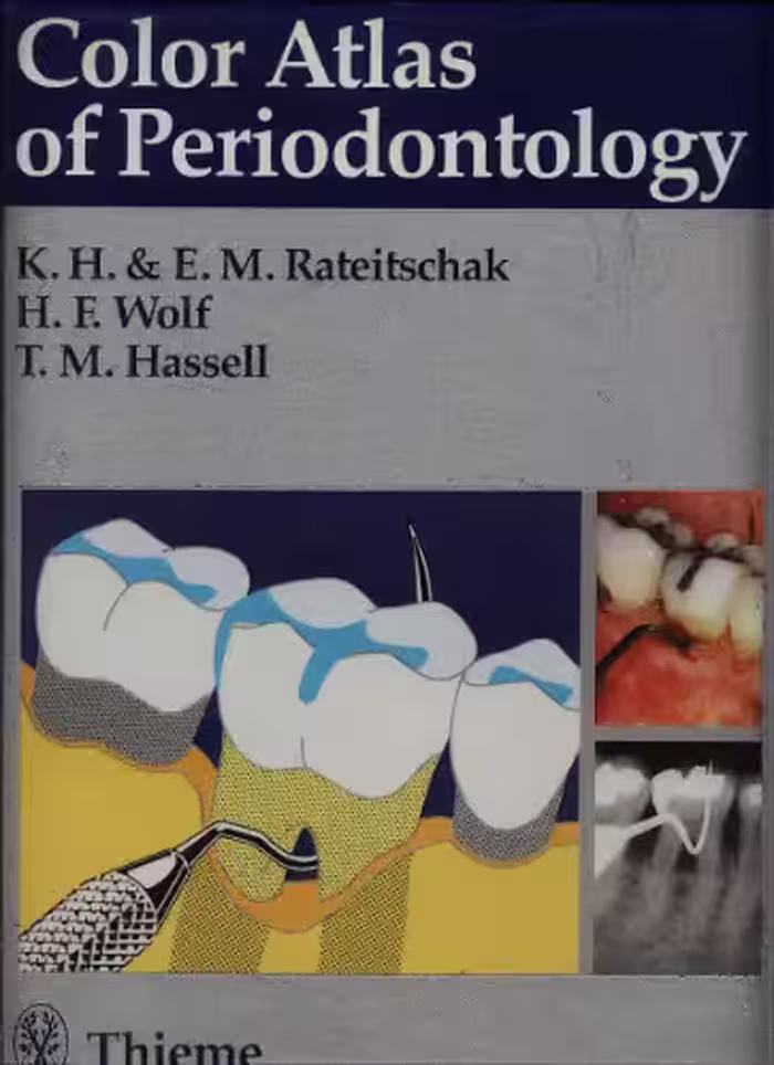 خرید و دانلود نسخه کامل کتاب Color atlas of periodontology