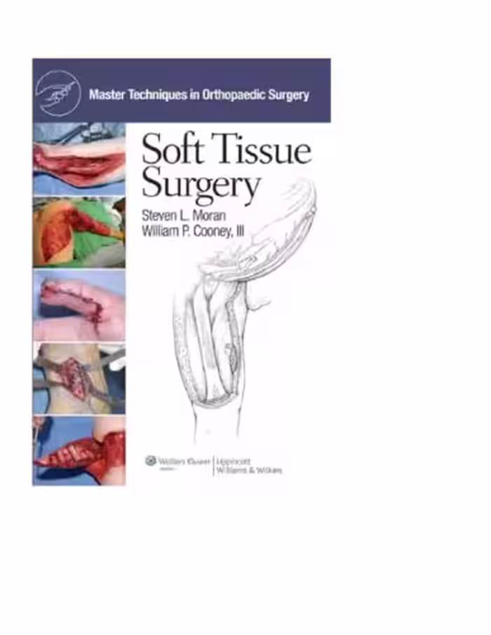 خرید و دانلود نسخه کامل کتاب Master Techniques in Orthopaedic Surgery: Soft Tissue Surgery (Master Techniques in Orthopaedic Surgery)