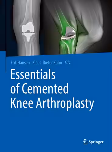 خرید و دانلود نسخه کامل کتاب Essentials of Cemented Knee Arthroplasty