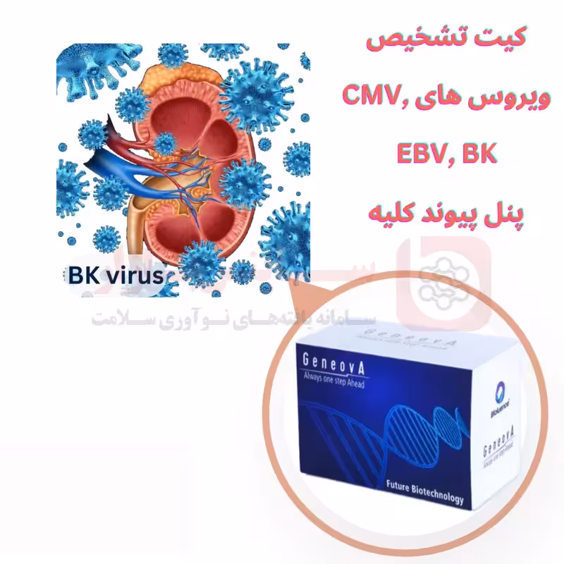 کیت تشخیص ویروس های CMV, EBV, BK | به روش TaqMan Real Time PCR