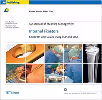 خرید و دانلود نسخه کامل کتاب AO Manual of Fracture Management: Internal Fixators: Concepts and Cases using LCP/LISS - Orginal Pdf