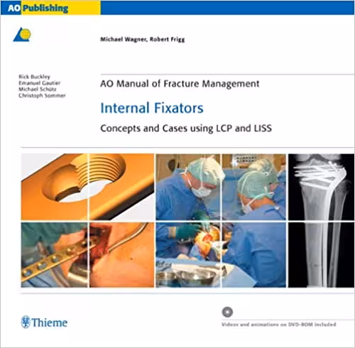 خرید و دانلود نسخه کامل کتاب AO Manual of Fracture Management: Internal Fixators: Concepts and Cases using LCP/LISS - Orginal Pdf
