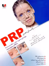 راهنمای مصور PRP رمزی آبادیس طب