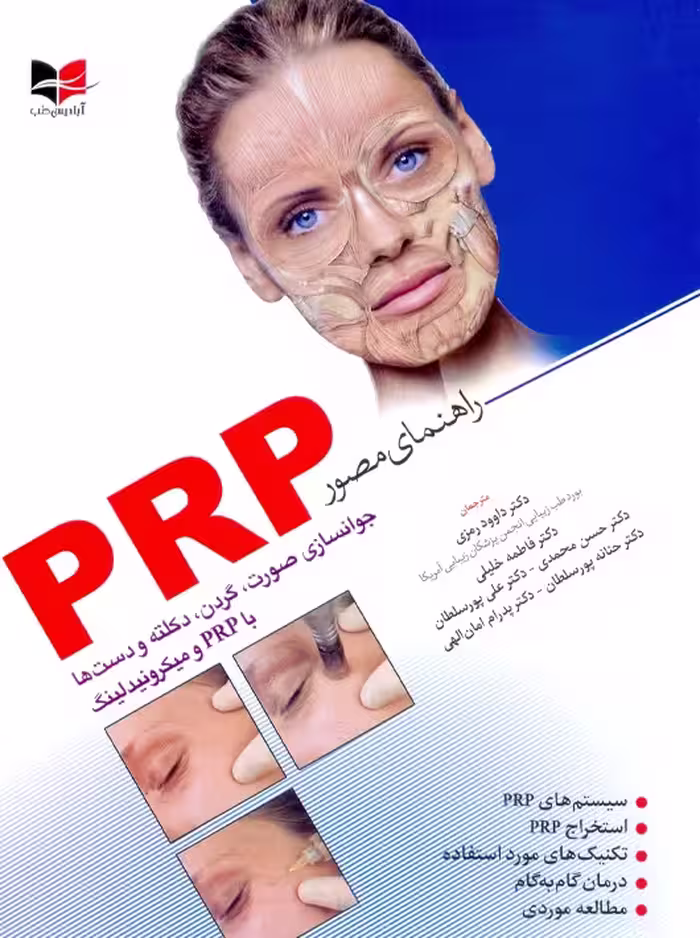 راهنمای مصور PRP رمزی آبادیس طب