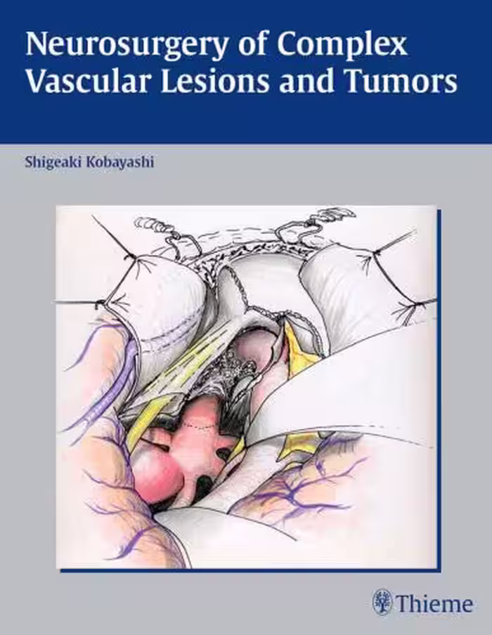 خرید و دانلود نسخه کامل کتاب Neurosurgery of Complex Vascular Lesions and Tumors