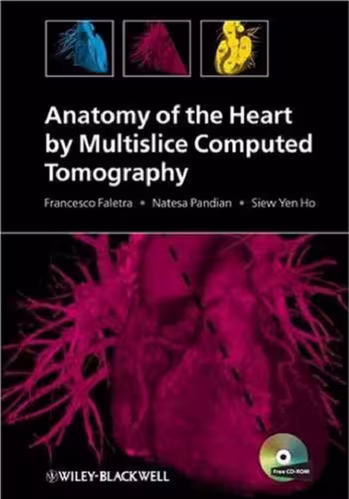 خرید و دانلود نسخه کامل کتاب Anatomy of the Heart by Multislice Computed Tomography