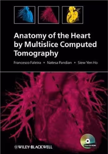 خرید و دانلود نسخه کامل کتاب Anatomy of the Heart by Multislice Computed Tomography